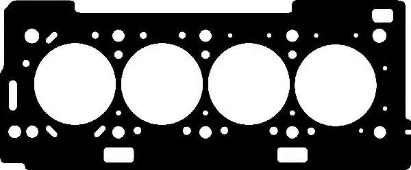 415013P